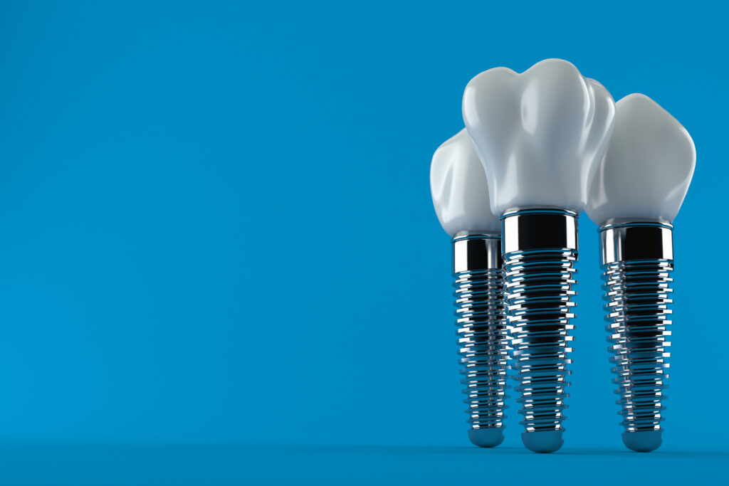 Dental Implants Bentonville